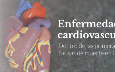 Enfermedad cardiovascular, dentro de las primeras causas de muerte en Colombia.